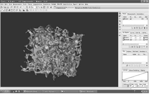 Pore network model (PNM)-based bionic bone scaffold designing method