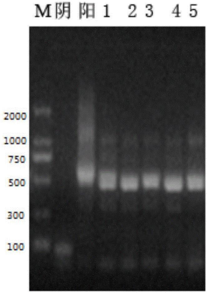 Diazepam lipocalin imitating antibody