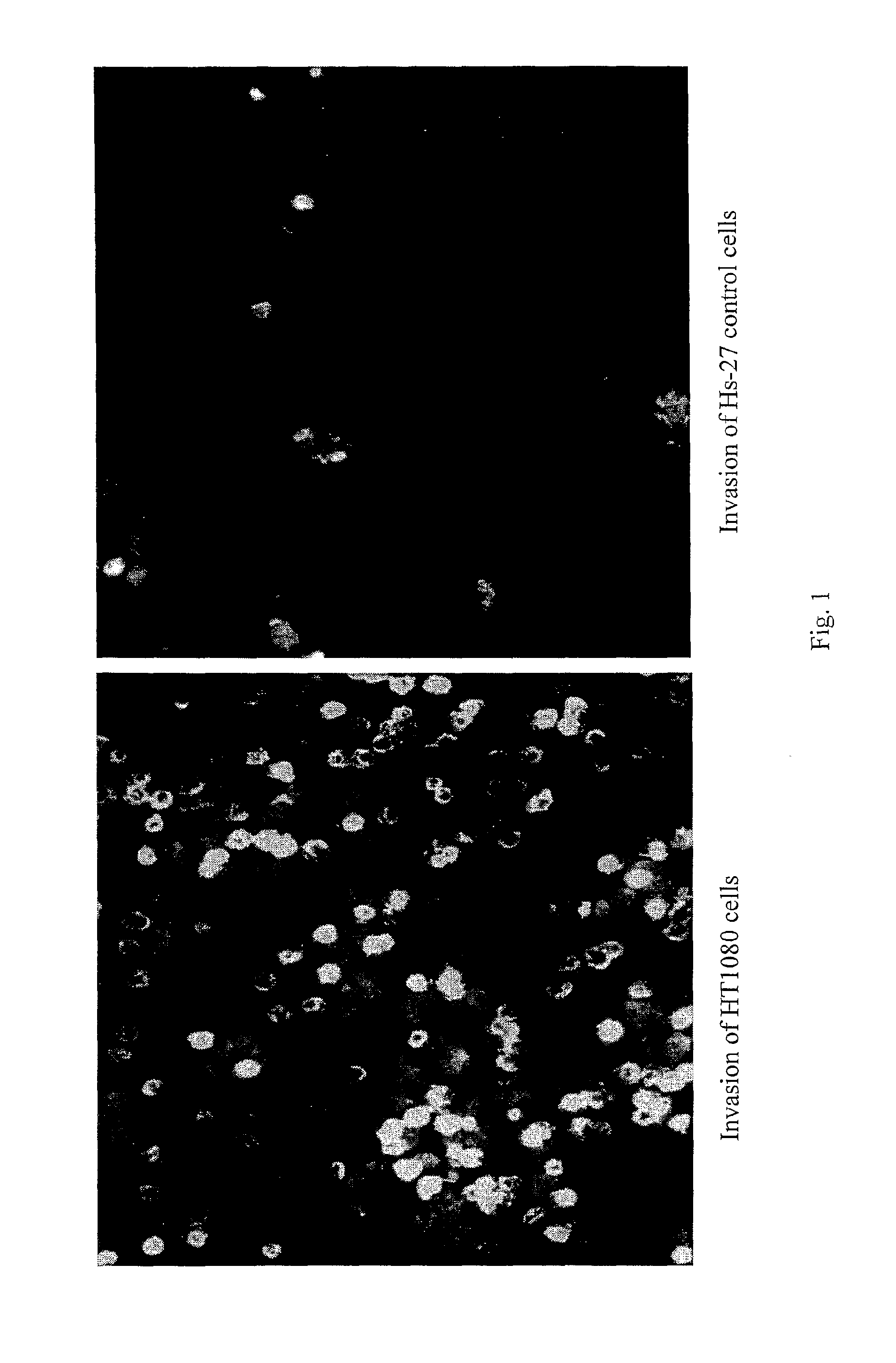 Neuropilin-1 inhibitors