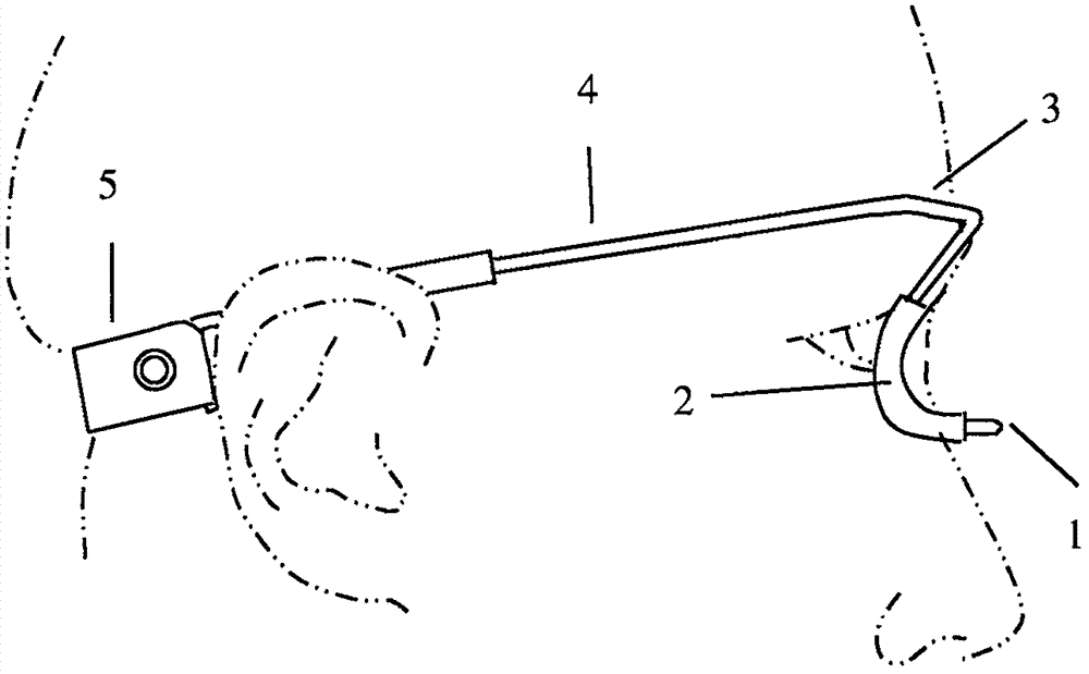 Nasolacrimal compression device