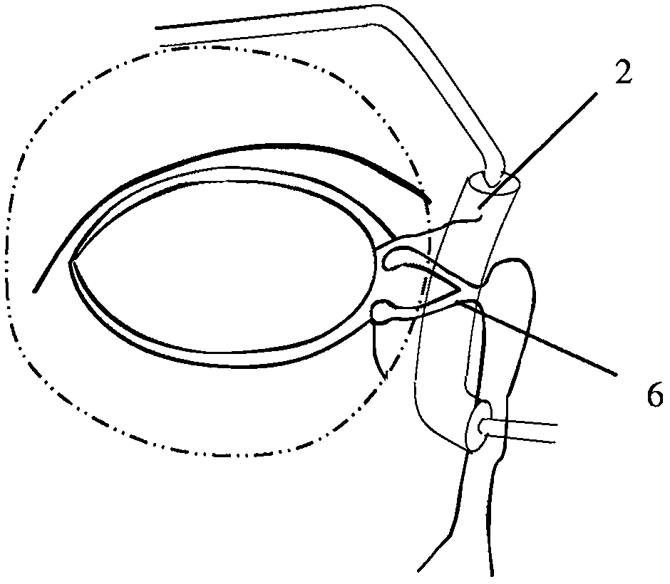 Nasolacrimal compression device