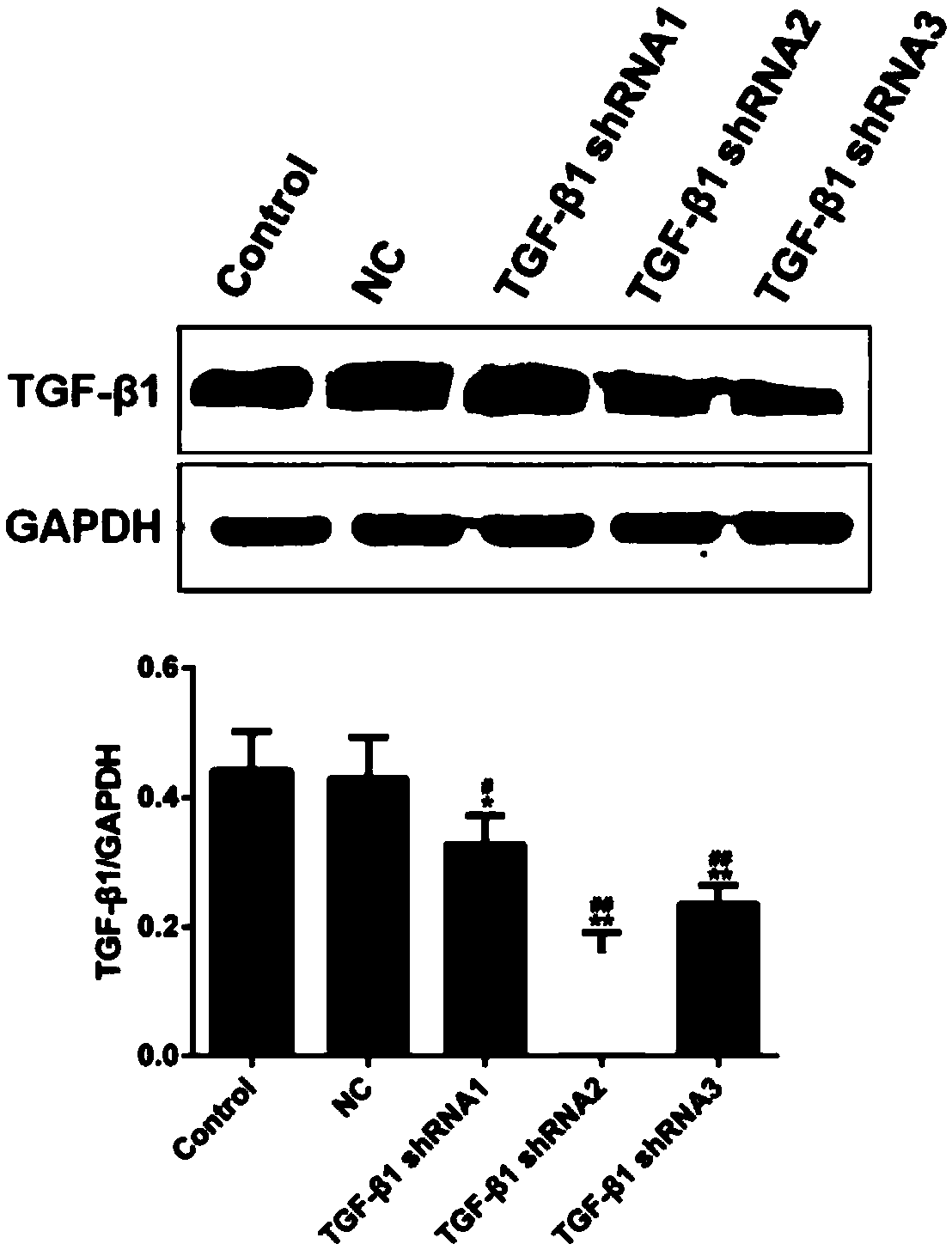 shRNA and vector for knocking down TGF-beta1 (Transforming Growth Factor-beta 1), kit and application of shRNA or vector or kit