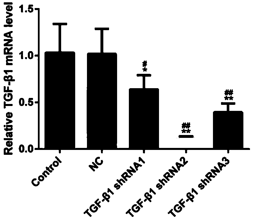 shRNA and vector for knocking down TGF-beta1 (Transforming Growth Factor-beta 1), kit and application of shRNA or vector or kit