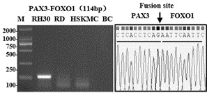 Molecular marker of rhabdomyosarcoma fusion gene related circular RNA and application of molecular marker