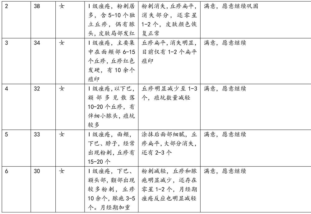 External compound formula for treating acne and preparation method of external compound formula