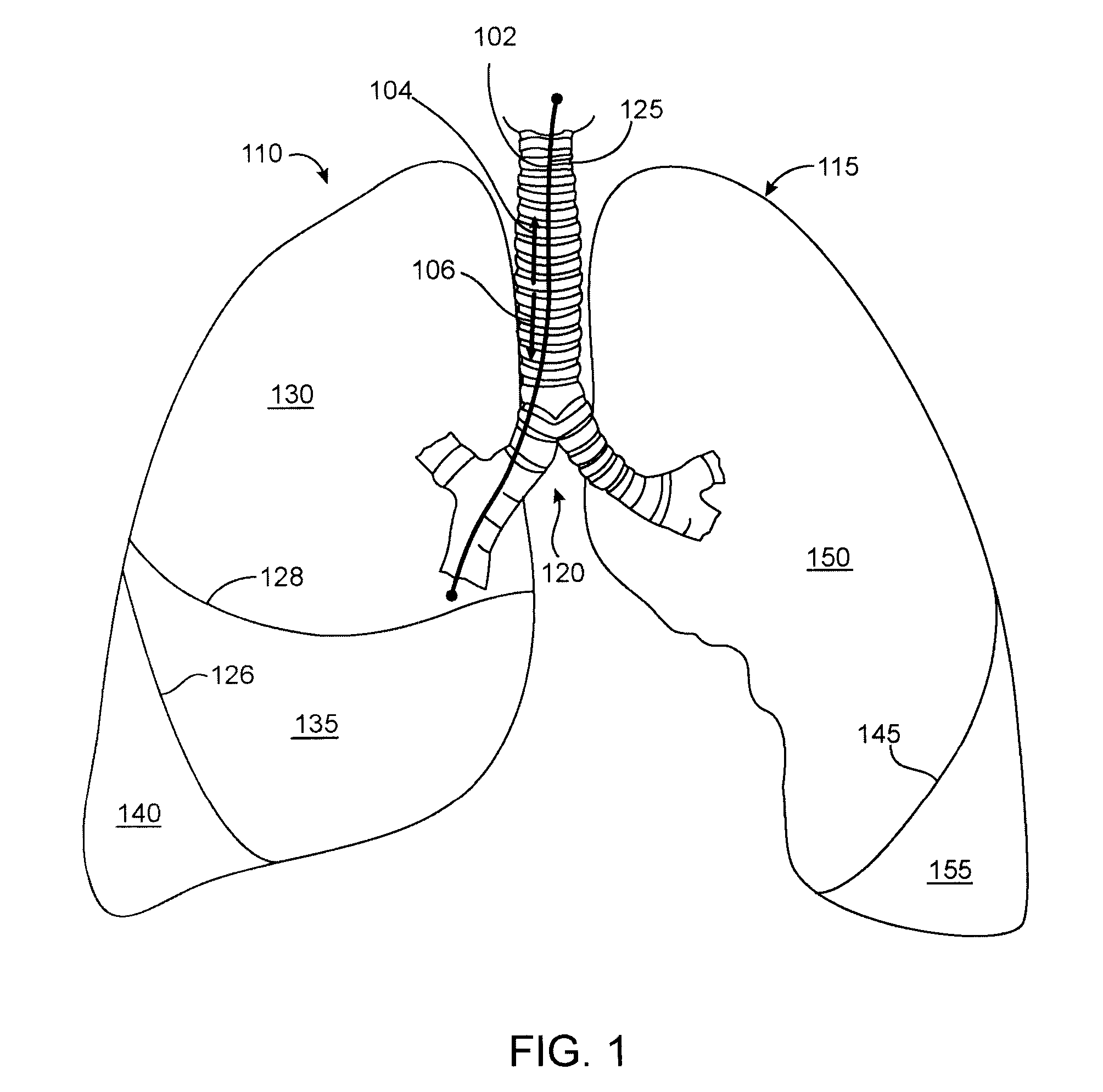 Methods and Devices for Lung Treatment