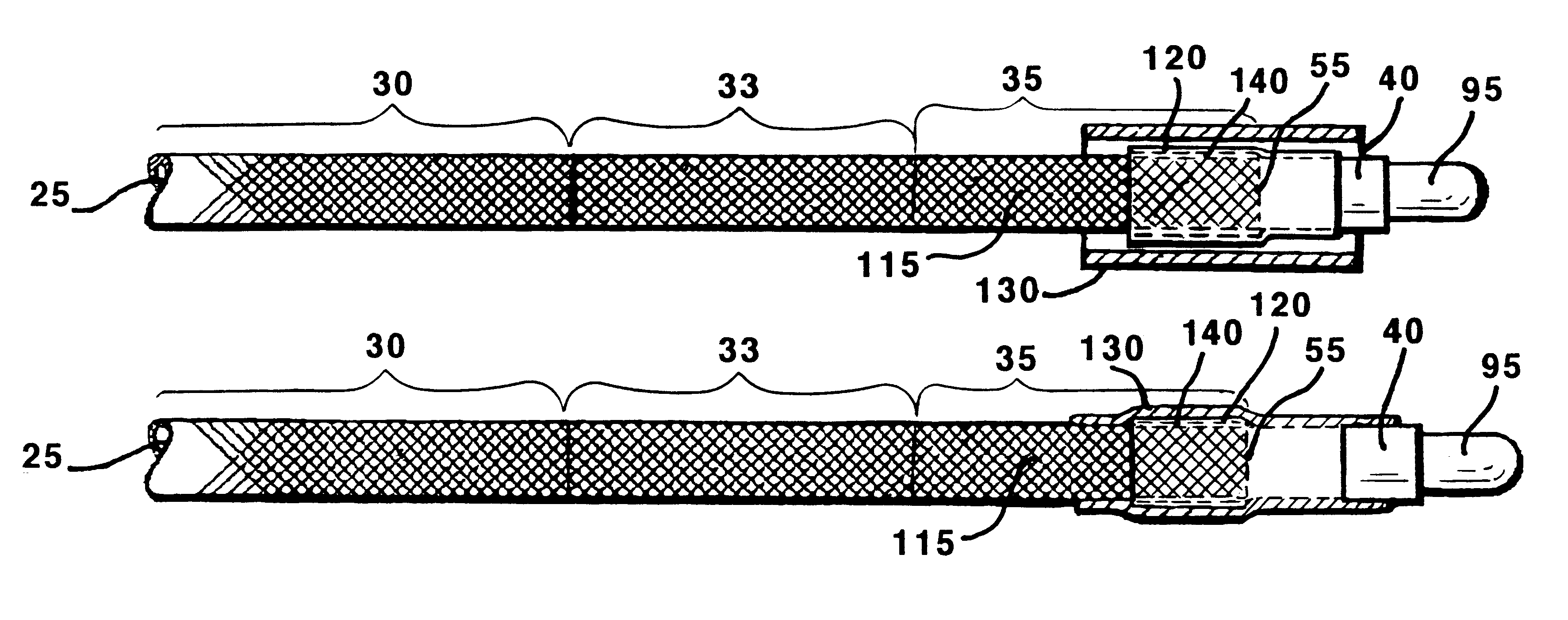 Guiding catheter with radiopaque band