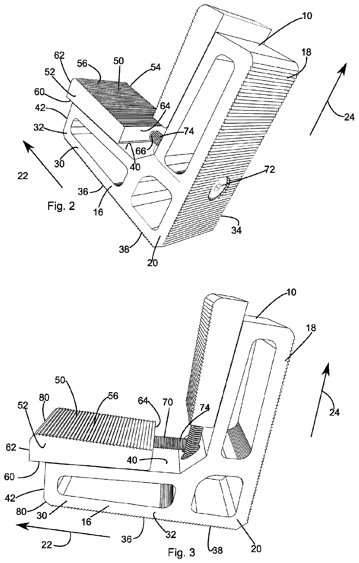 Mitre joint support