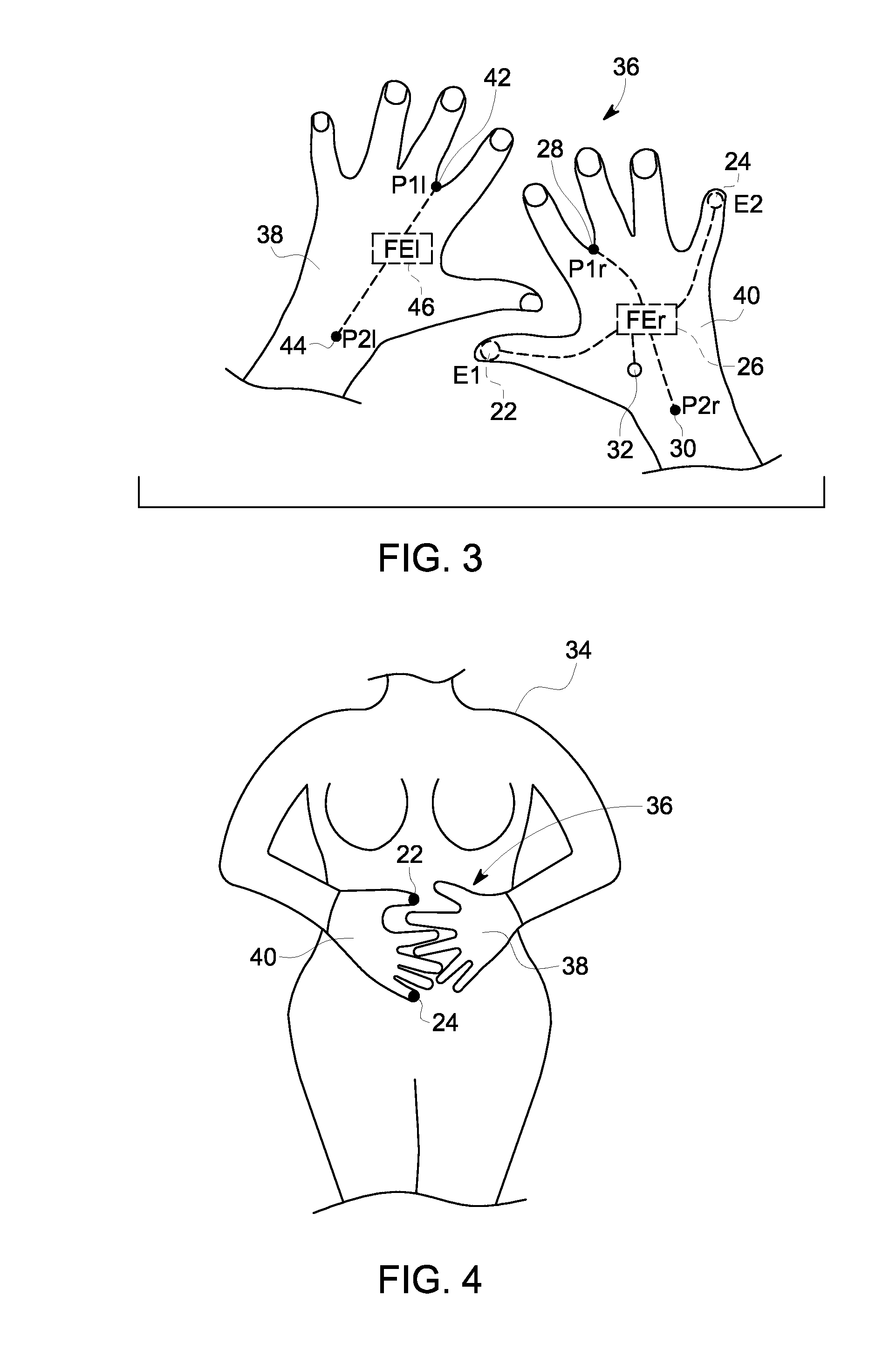 Fetal Monitoring Device and Method