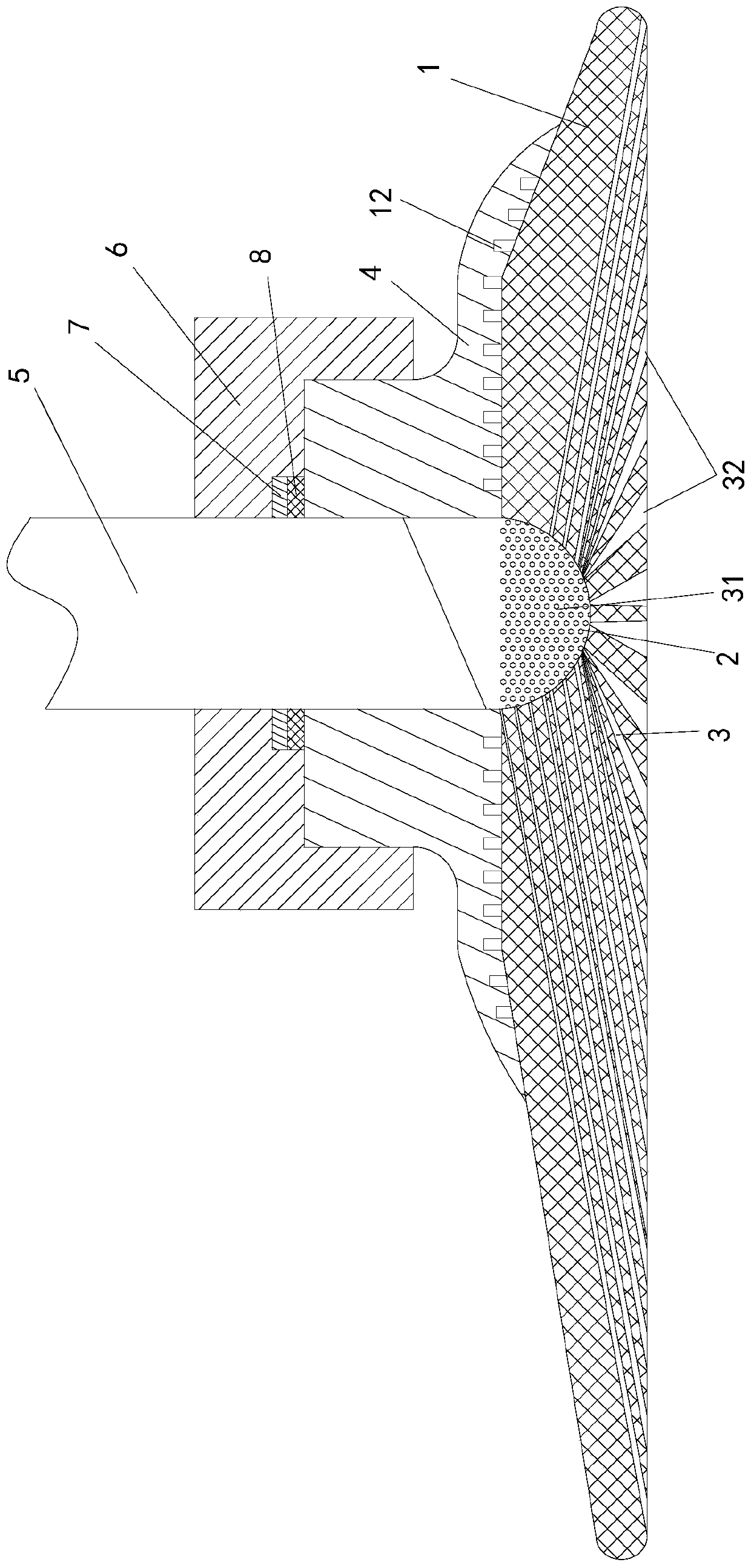 Noninvasive valve fixator