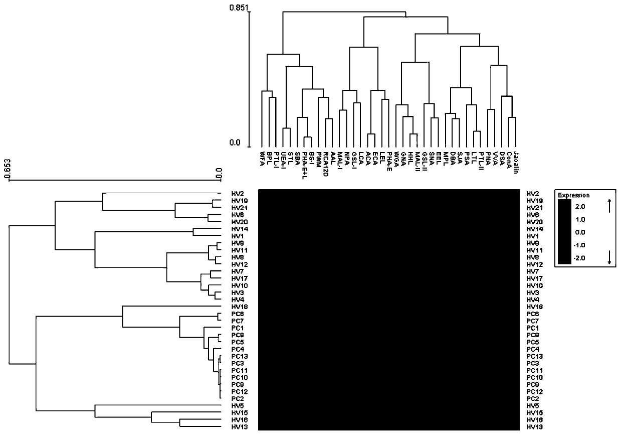 Application of specific lectin in identification of pancreatic cancer based on saliva glycoprotein sugar chain structure and related product