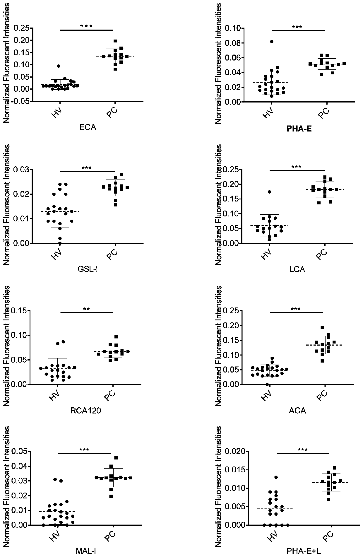 Application of specific lectin in identification of pancreatic cancer based on saliva glycoprotein sugar chain structure and related product