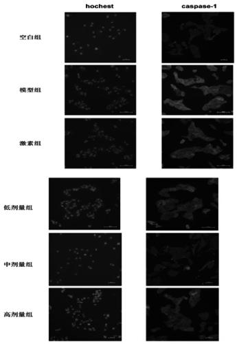 Traditional Chinese medicine compound preparation for treating subacute thyroiditis in acute stage and preparation method of traditional Chinese medicine compound preparation