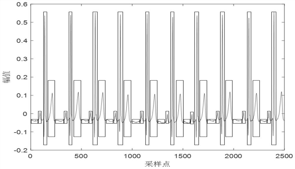 Electrocardiosignal feature point detection method and system