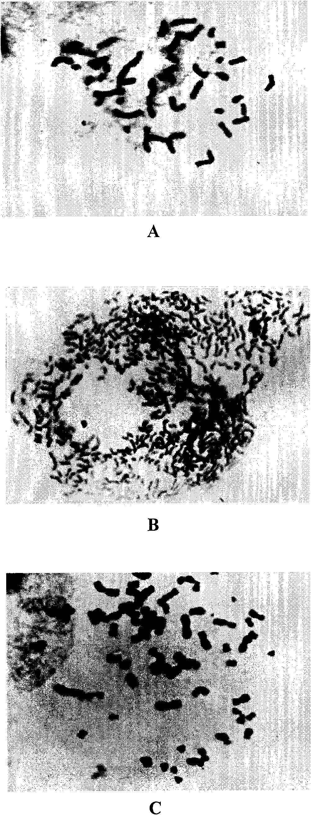 Human tumor stem cell line and application thereof