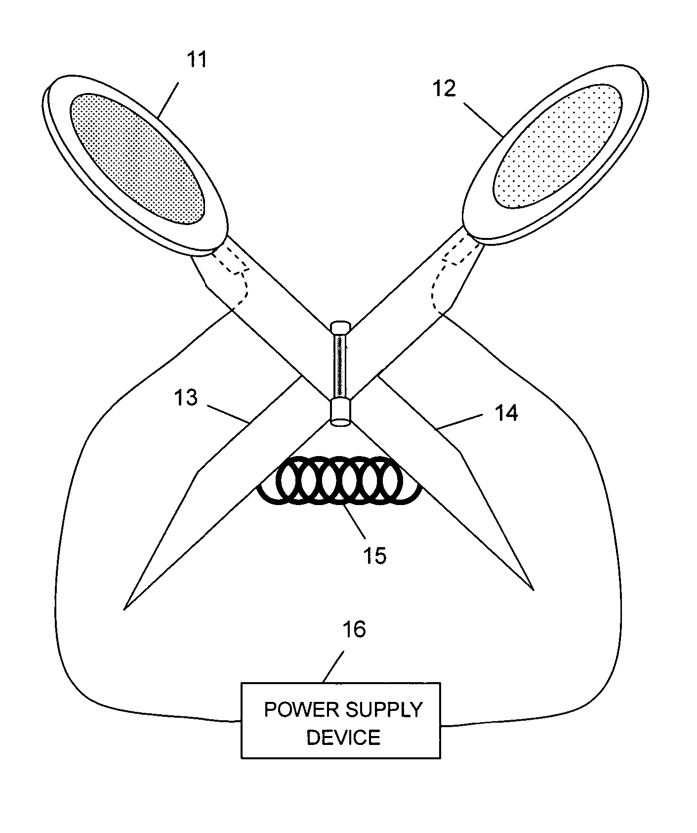 Iontophoresis system