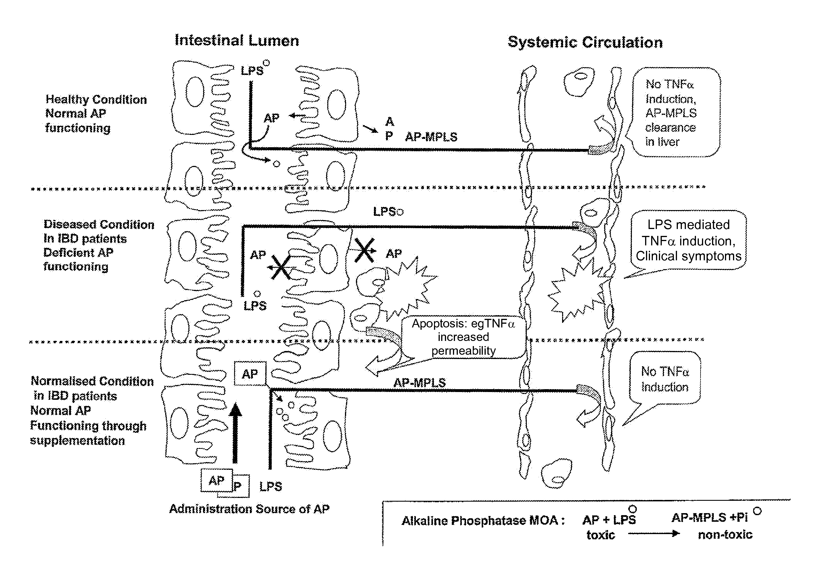 Means and method for treating and/or preventing necrotizing enterocolitis