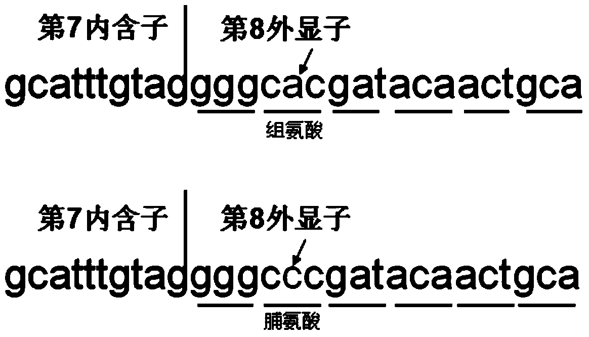 Kit for detecting common mutations of CYP4V2 gene