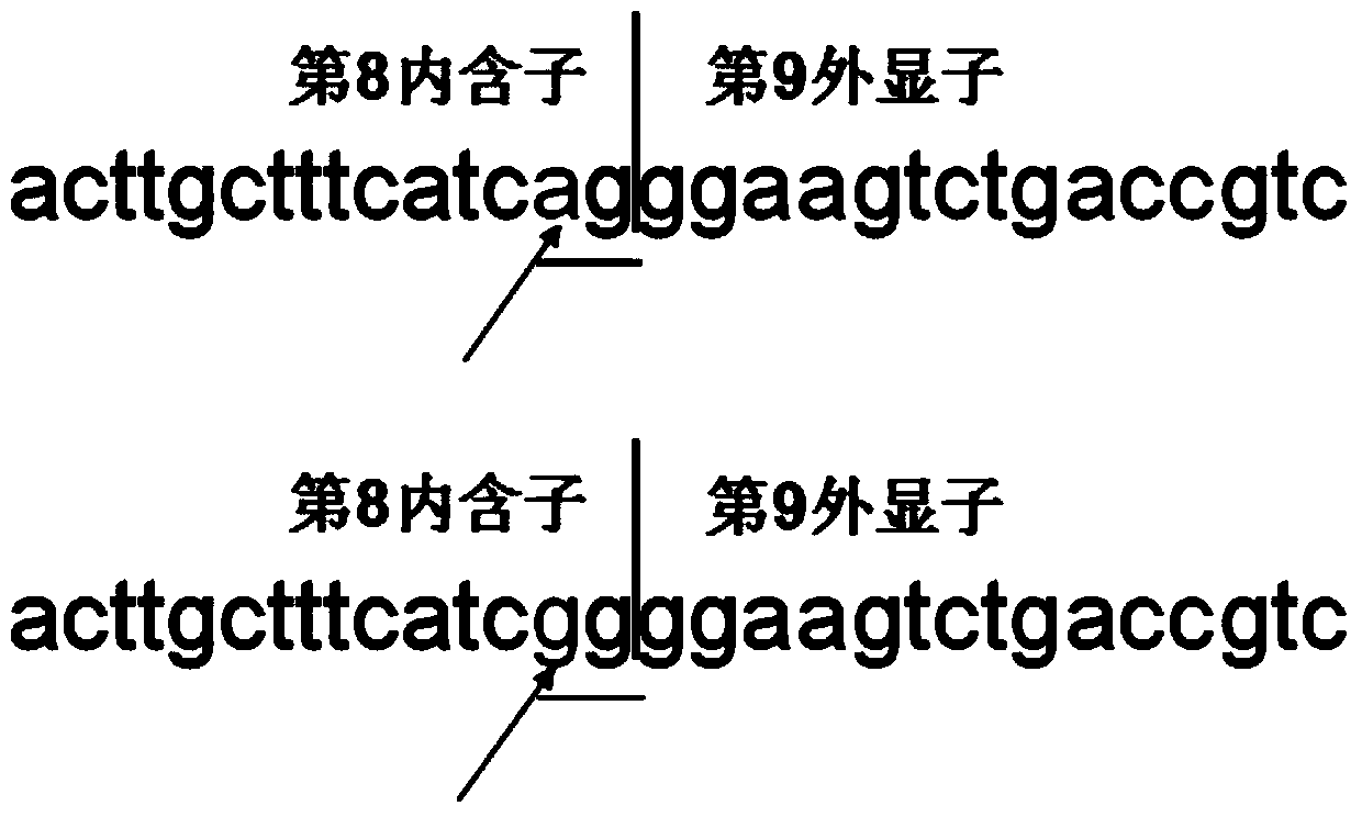 Kit for detecting common mutations of CYP4V2 gene