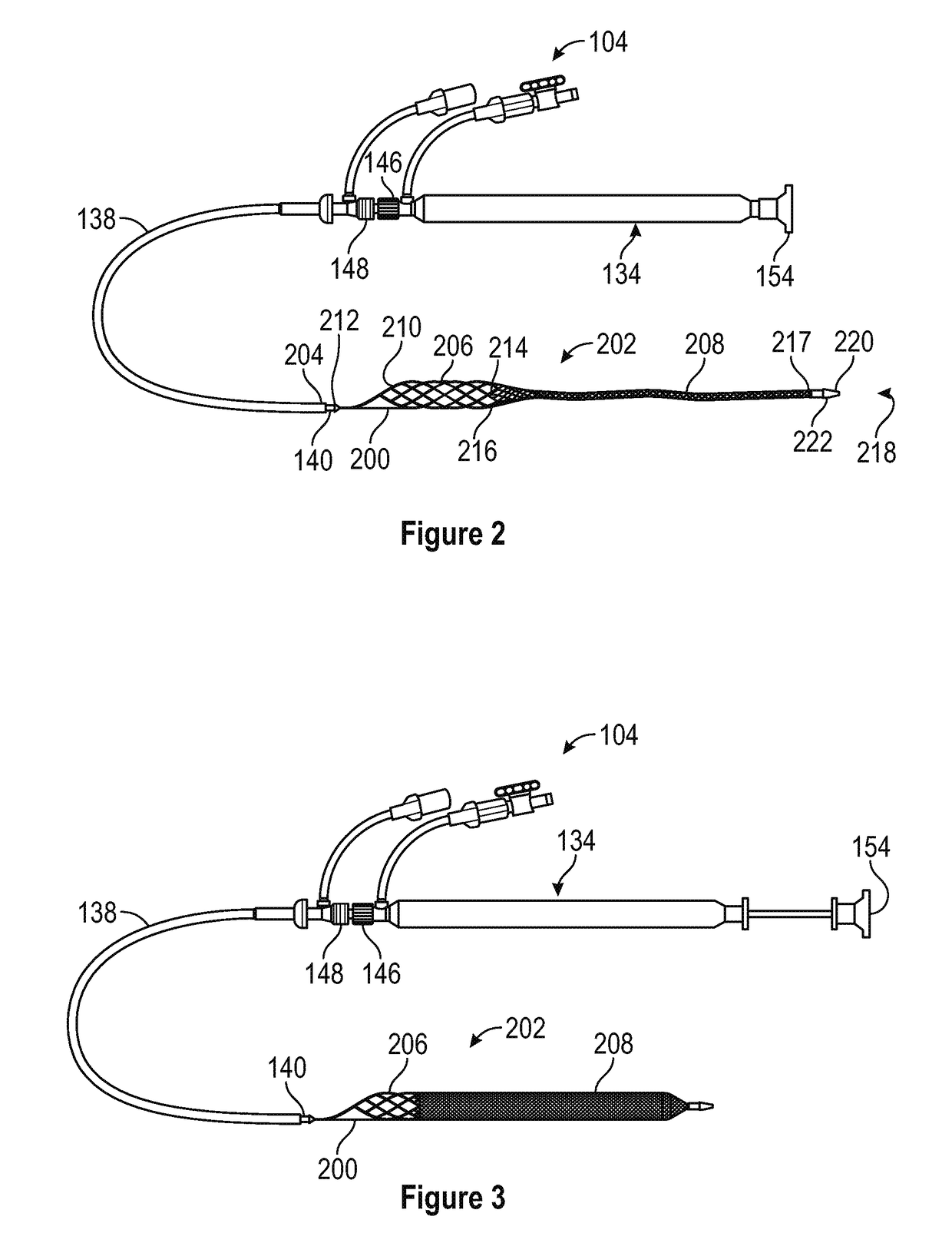 Devices and methods for treating vascular occlusion