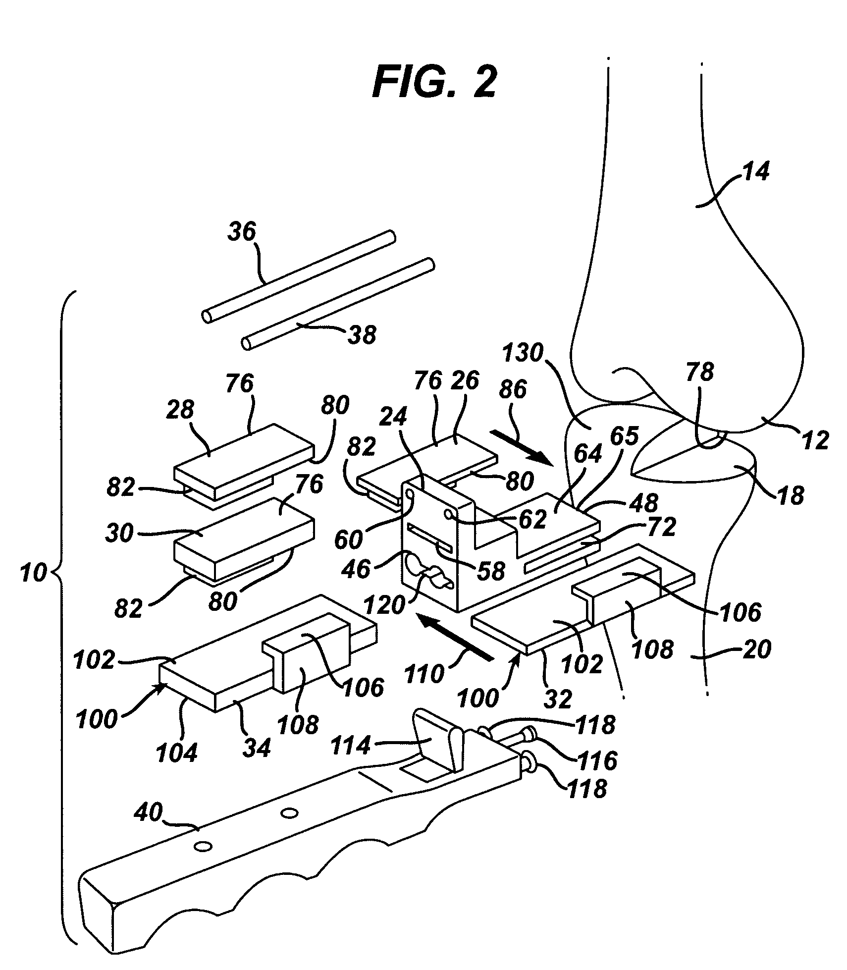 Kit, guide and method for locating distal femoral resection plane