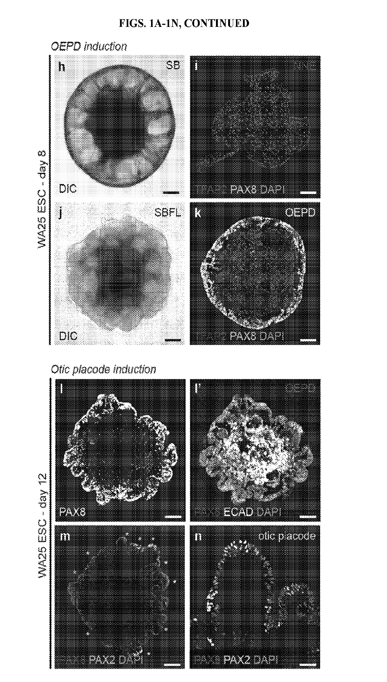 Methods of generating human inner ear sensory epithelia and sensory neurons