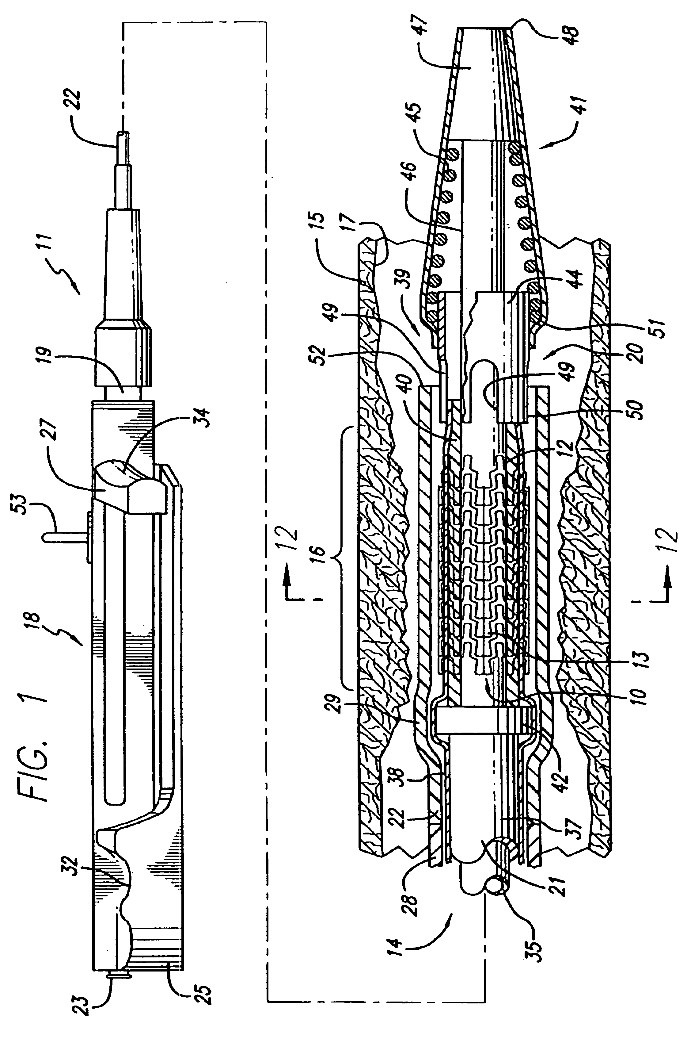 Self-expanding stent with enhanced delivery precision and stent delivery system