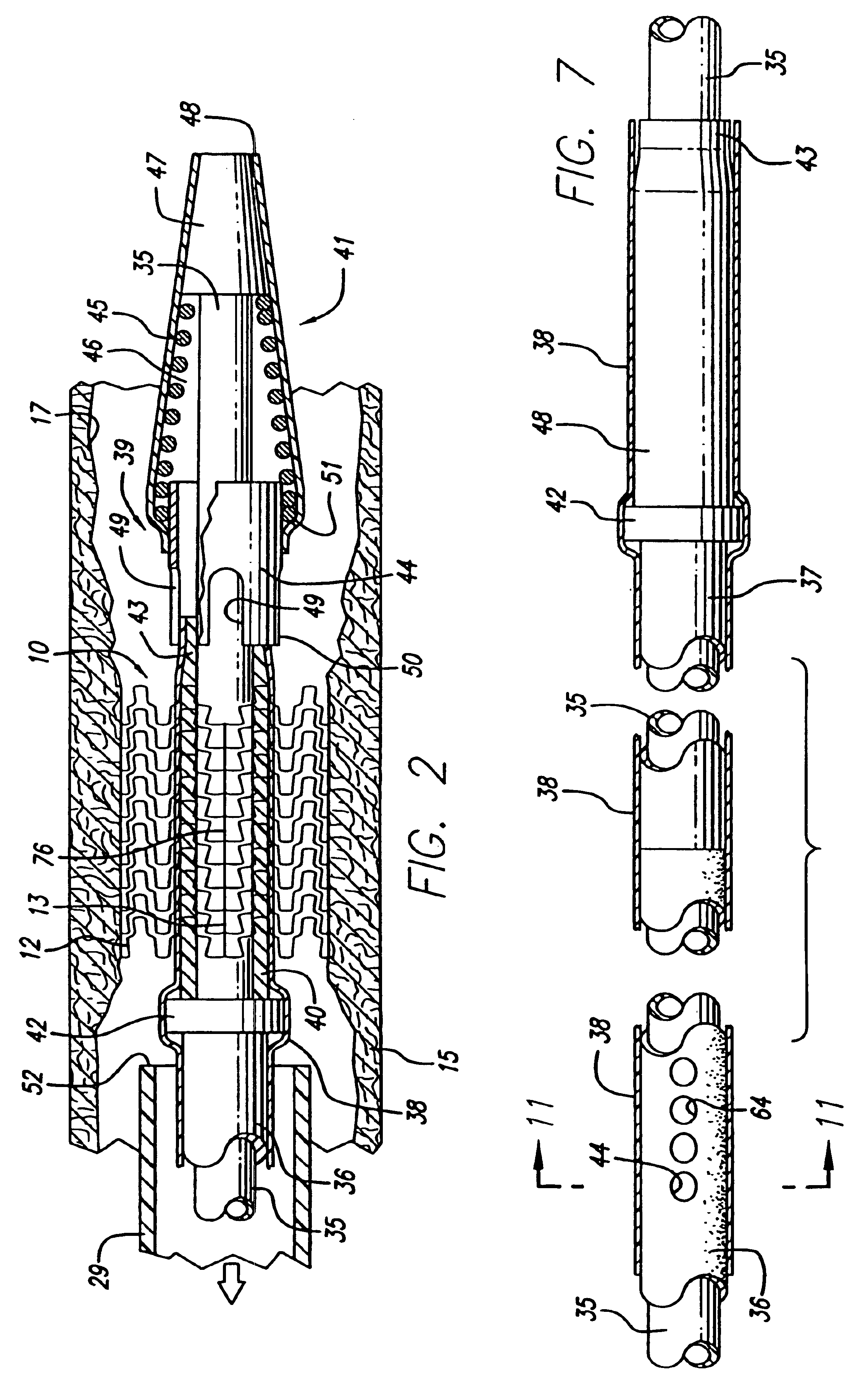 Self-expanding stent with enhanced delivery precision and stent delivery system