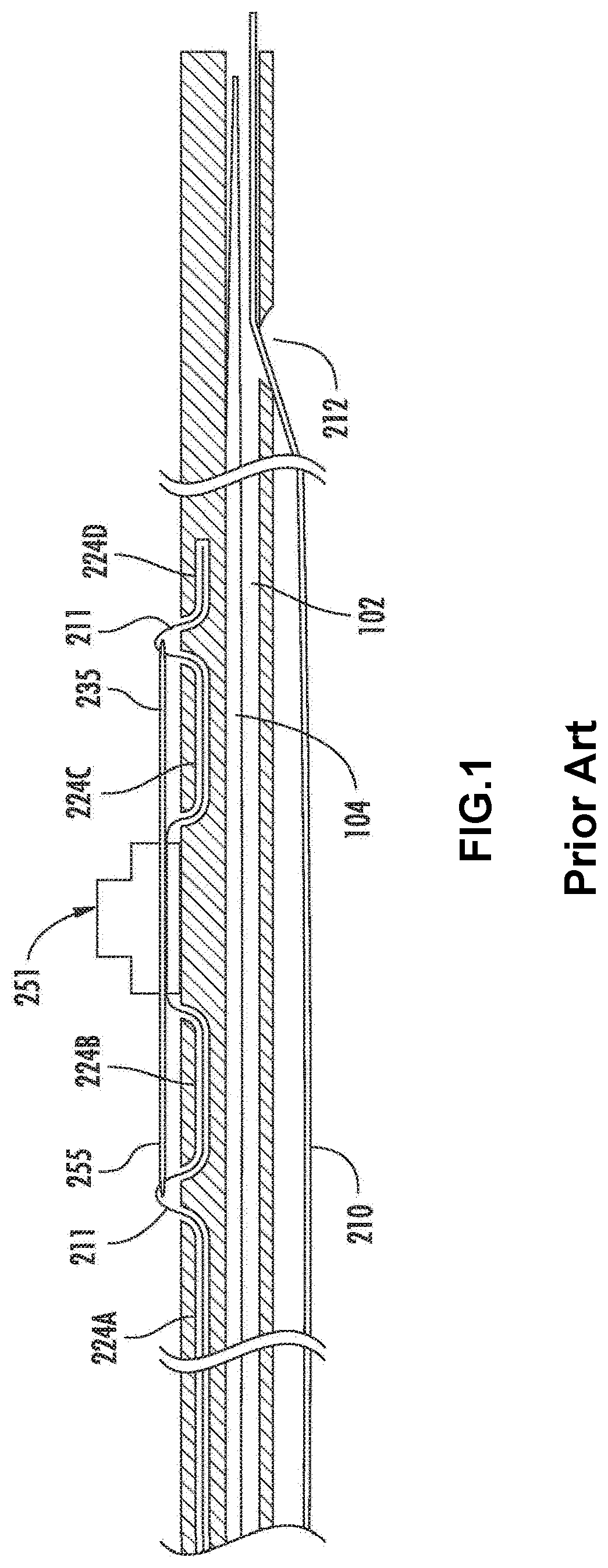 Systems and methods for delivering an implantable device