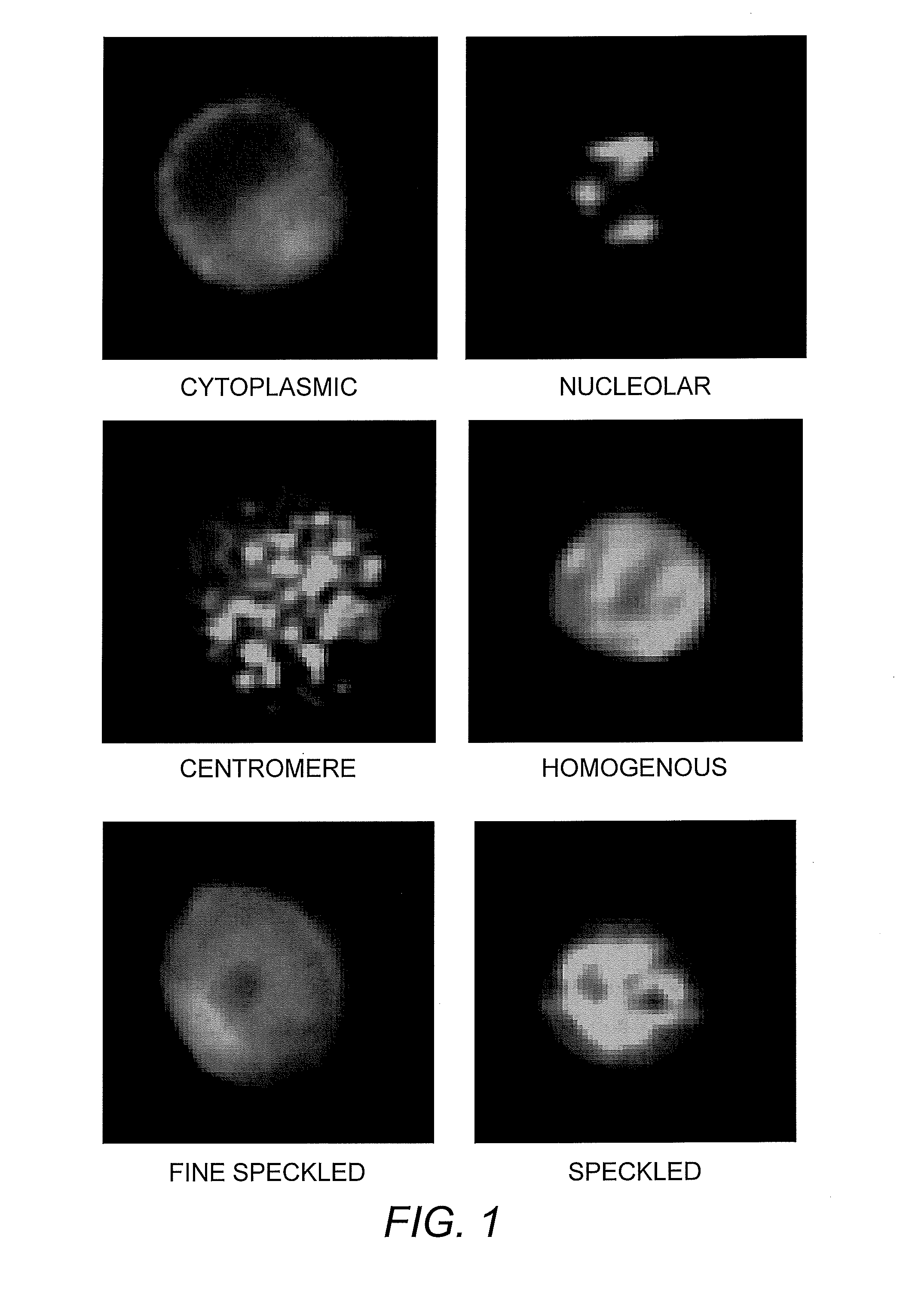 Method for Automated Autoantibody Detection and Identification