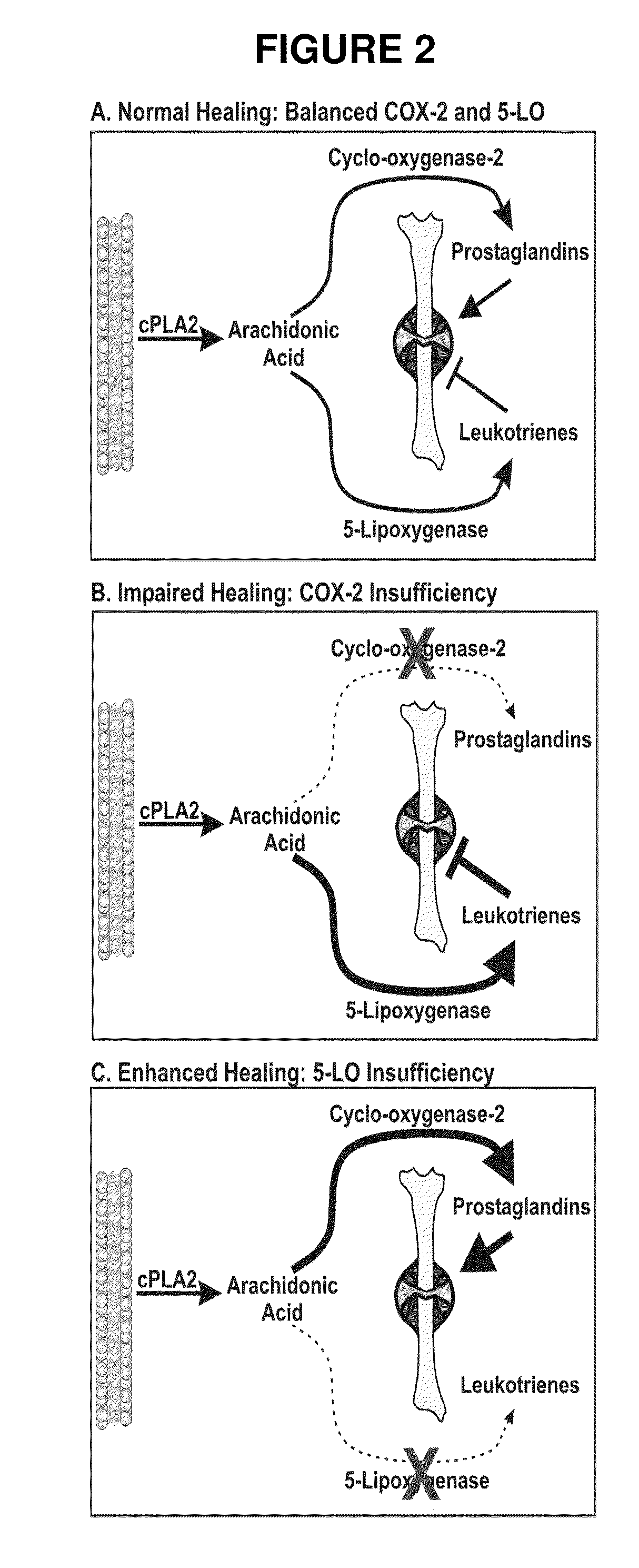 Novel Methods for Bone Treatment by Modulating an Arachidonic Acid Metabolic or Signaling Pathway