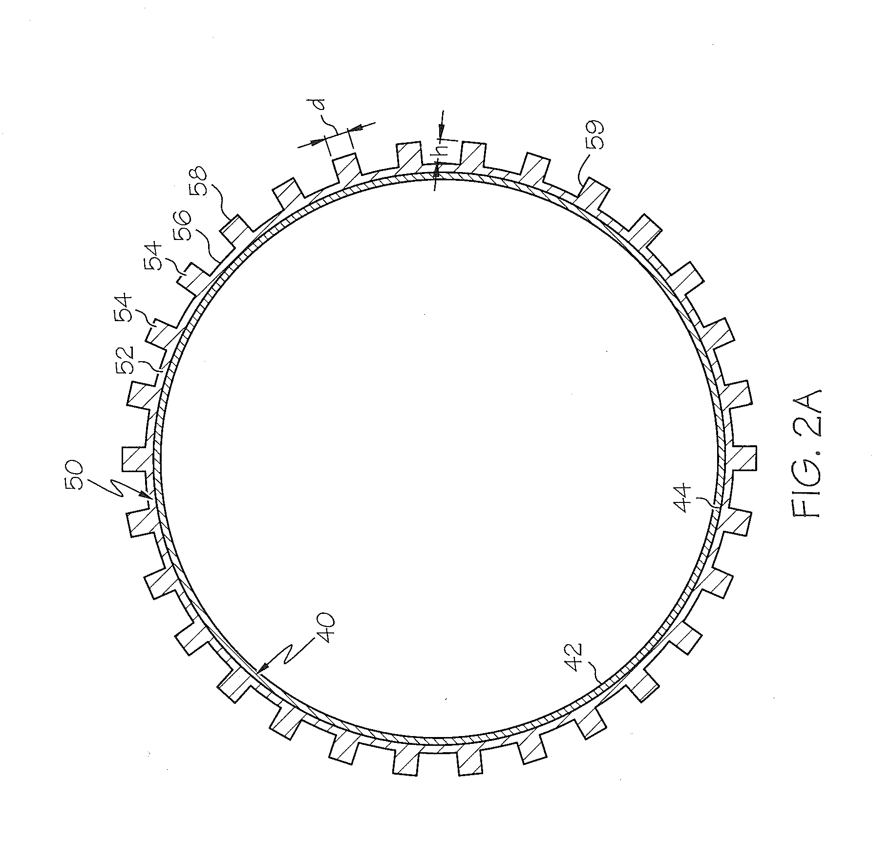 Anti-migration Micropatterned Stent Coating