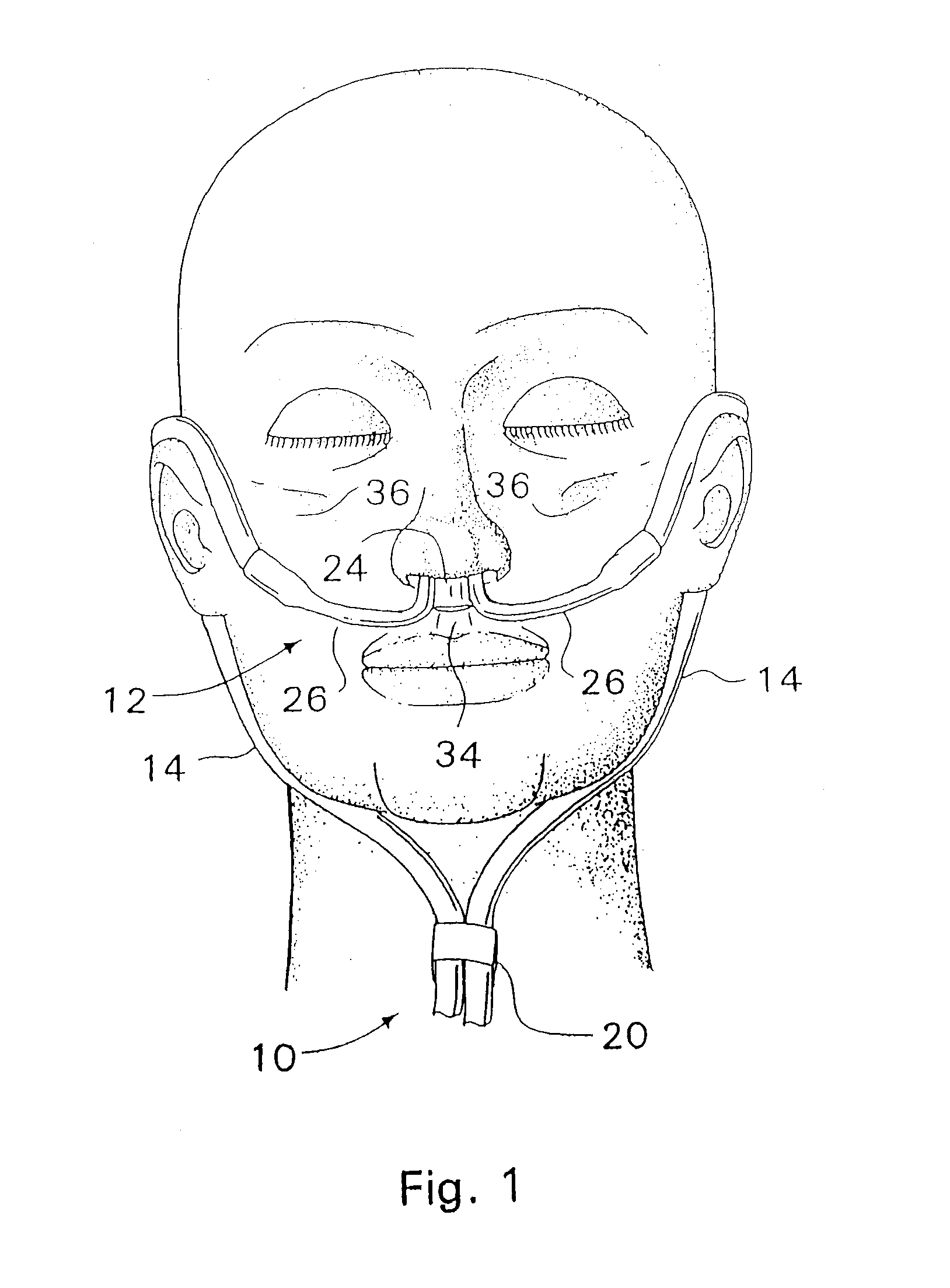 Respiratory therapy system including a nasal cannula assembly