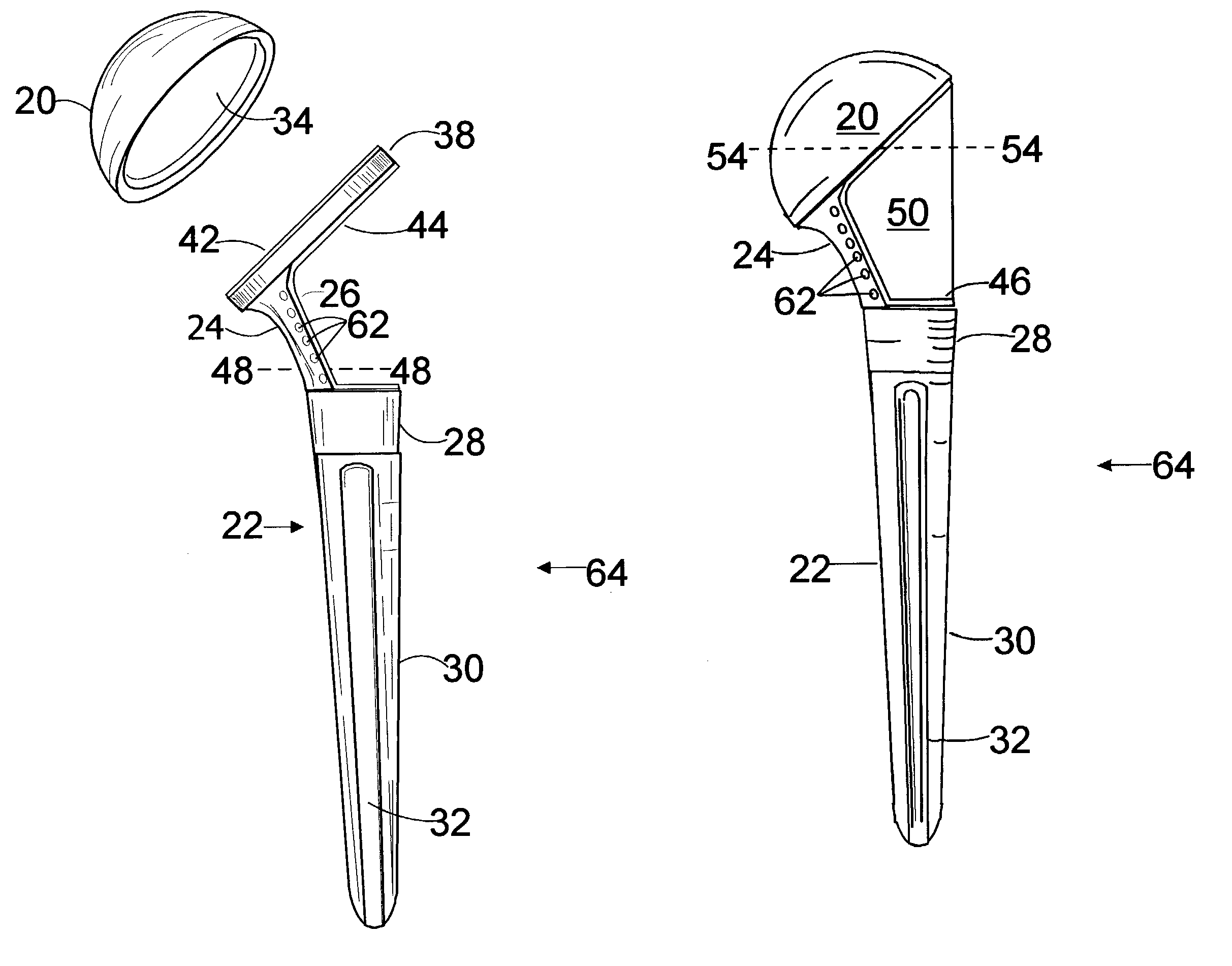 Composite shoulder prosthesis