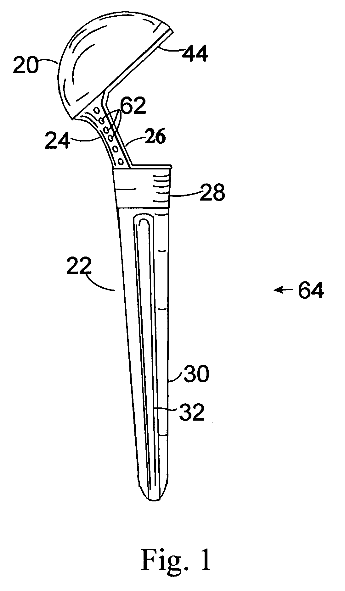 Composite shoulder prosthesis