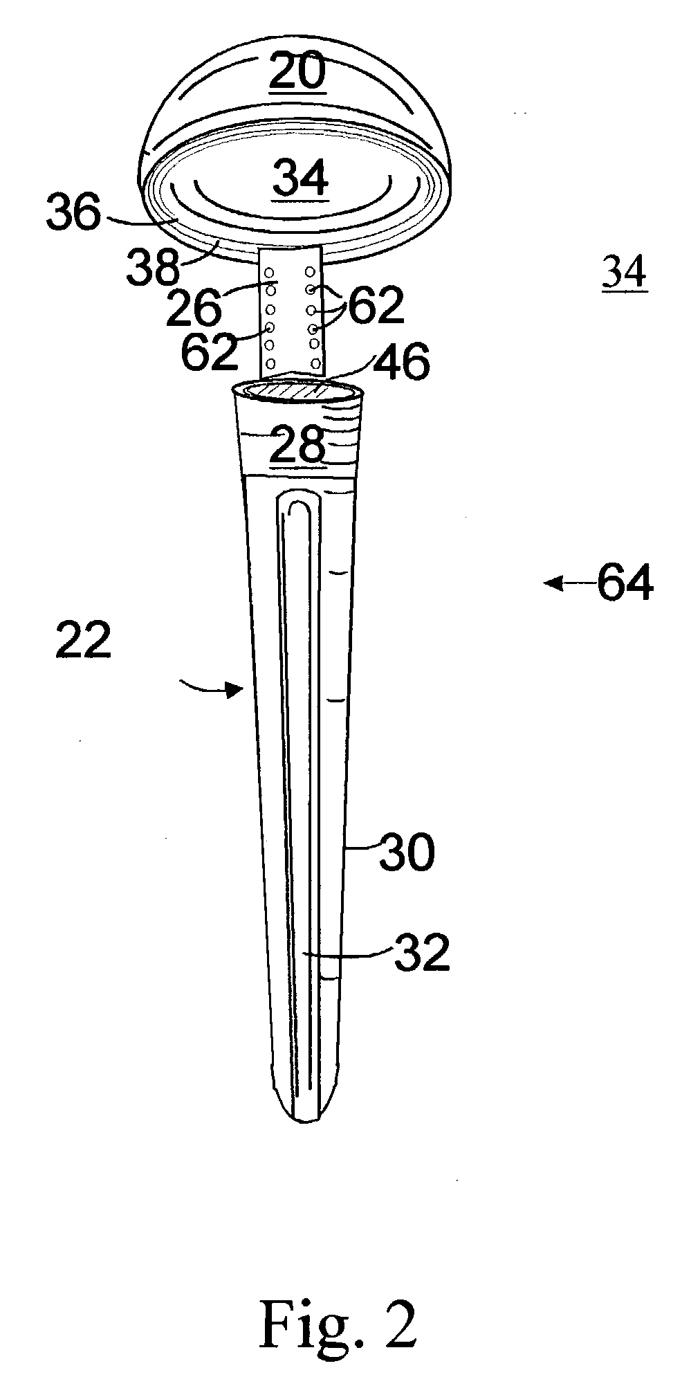 Composite shoulder prosthesis