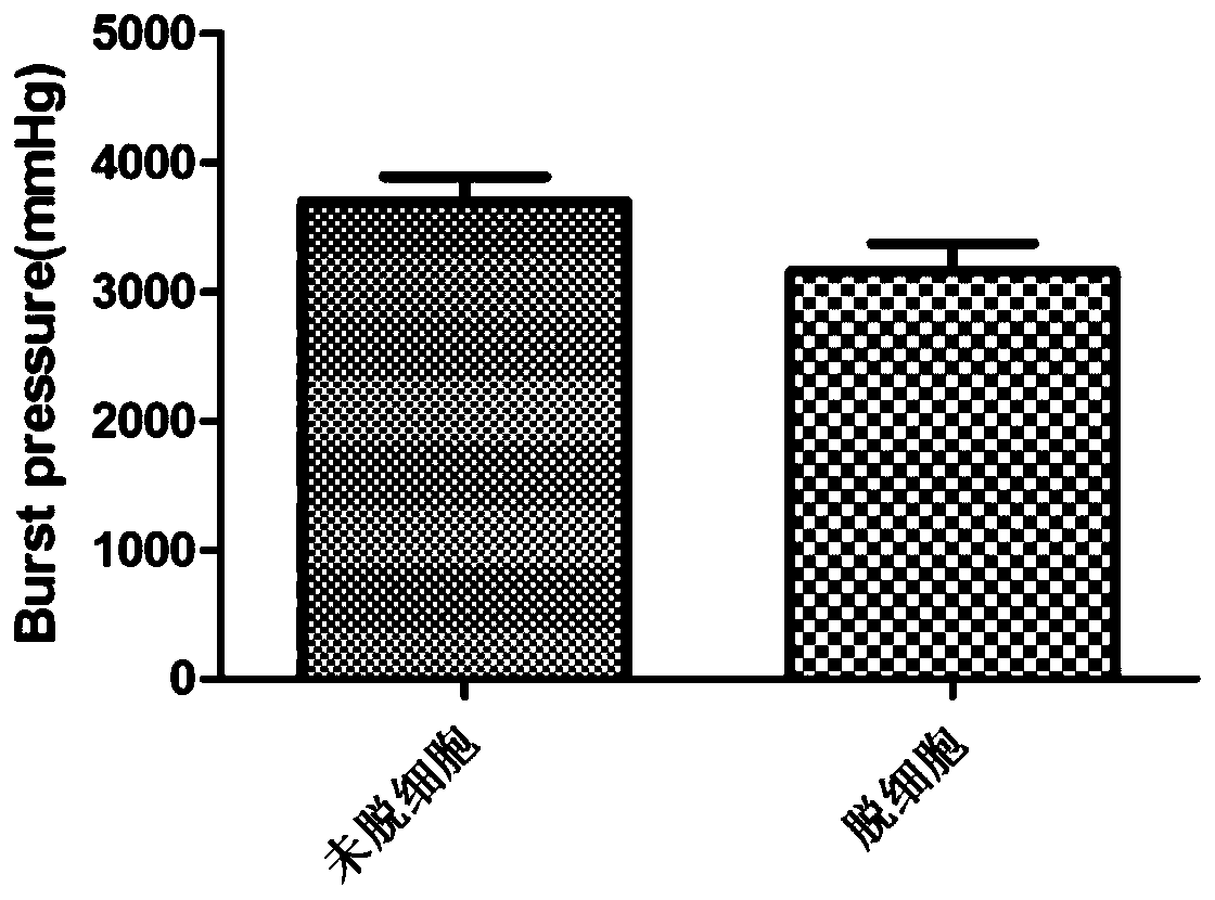 A kind of artificial blood vessel and preparation method thereof