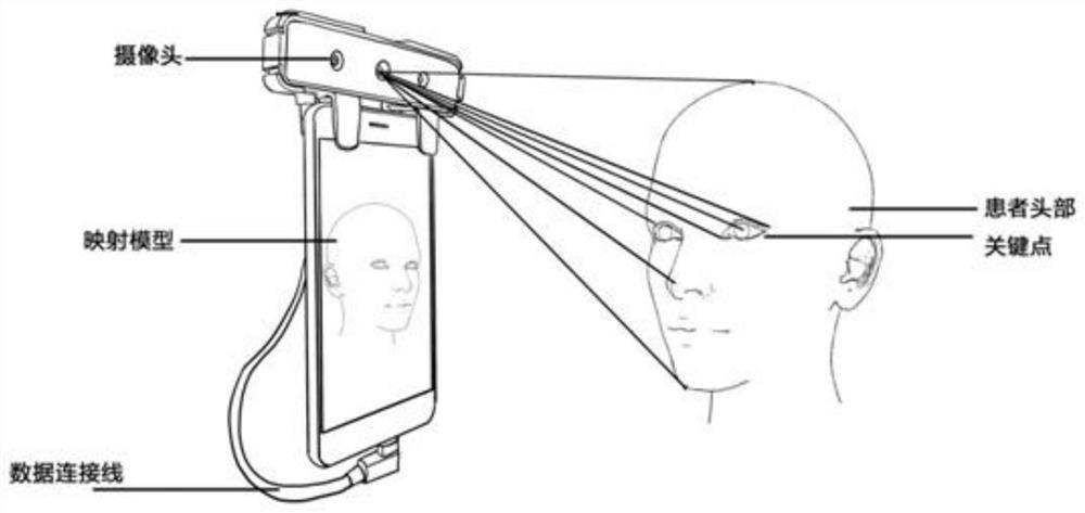 Orbital disease screening method and system based on three-dimensional model and terminal