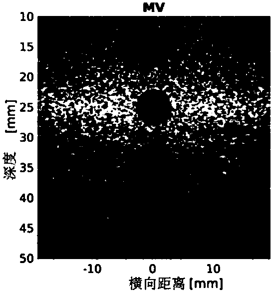 Quick medical ultrasonic image system for multiple MV high-definition algorithms based on GPU