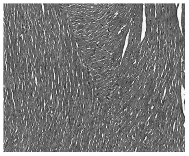 A preparation method of Chinese veterinary drug composition for treating livestock and poultry diarrhea