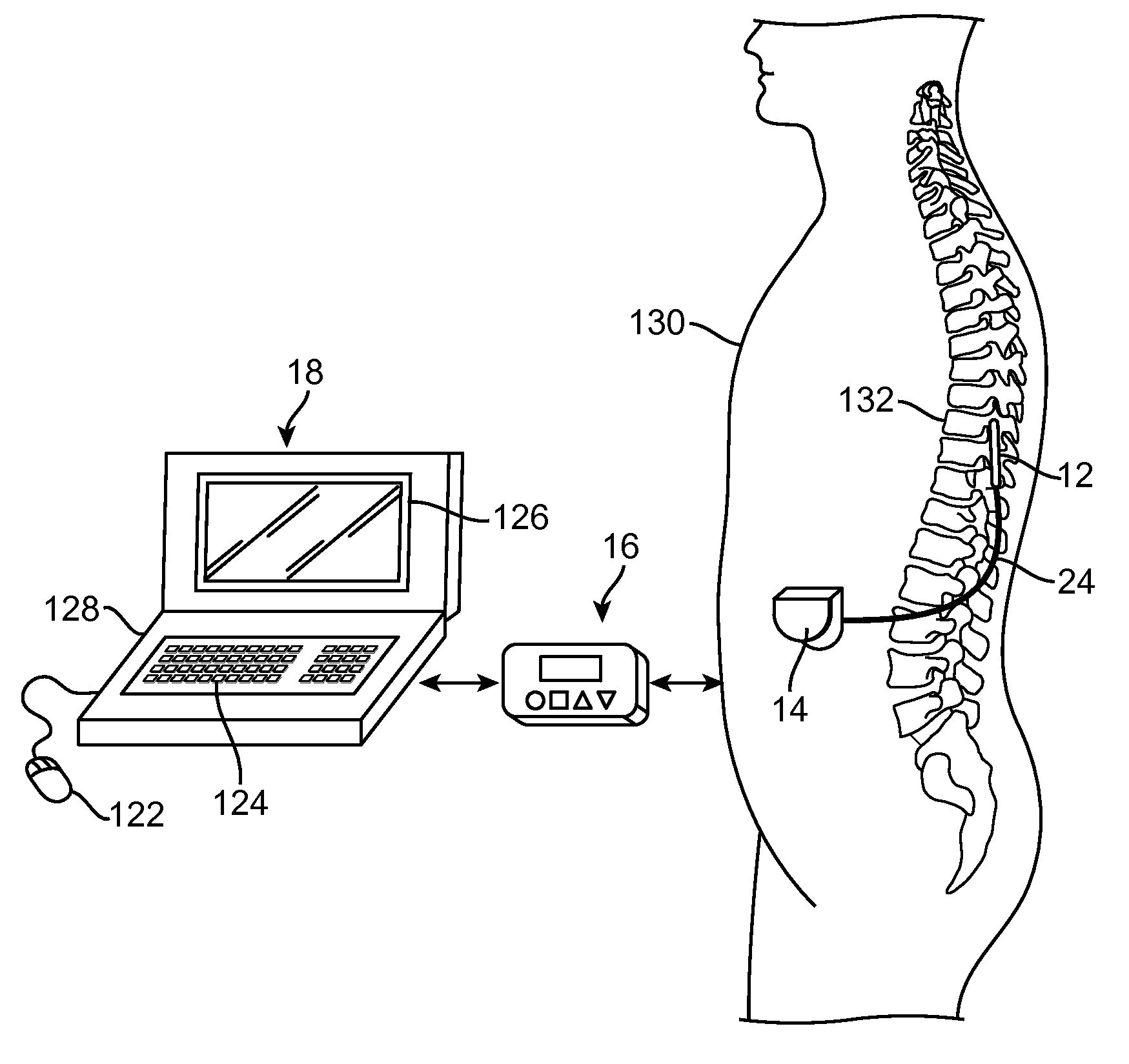 Electrical stimulation method for modulation on sensory information around dorsal root ganglia