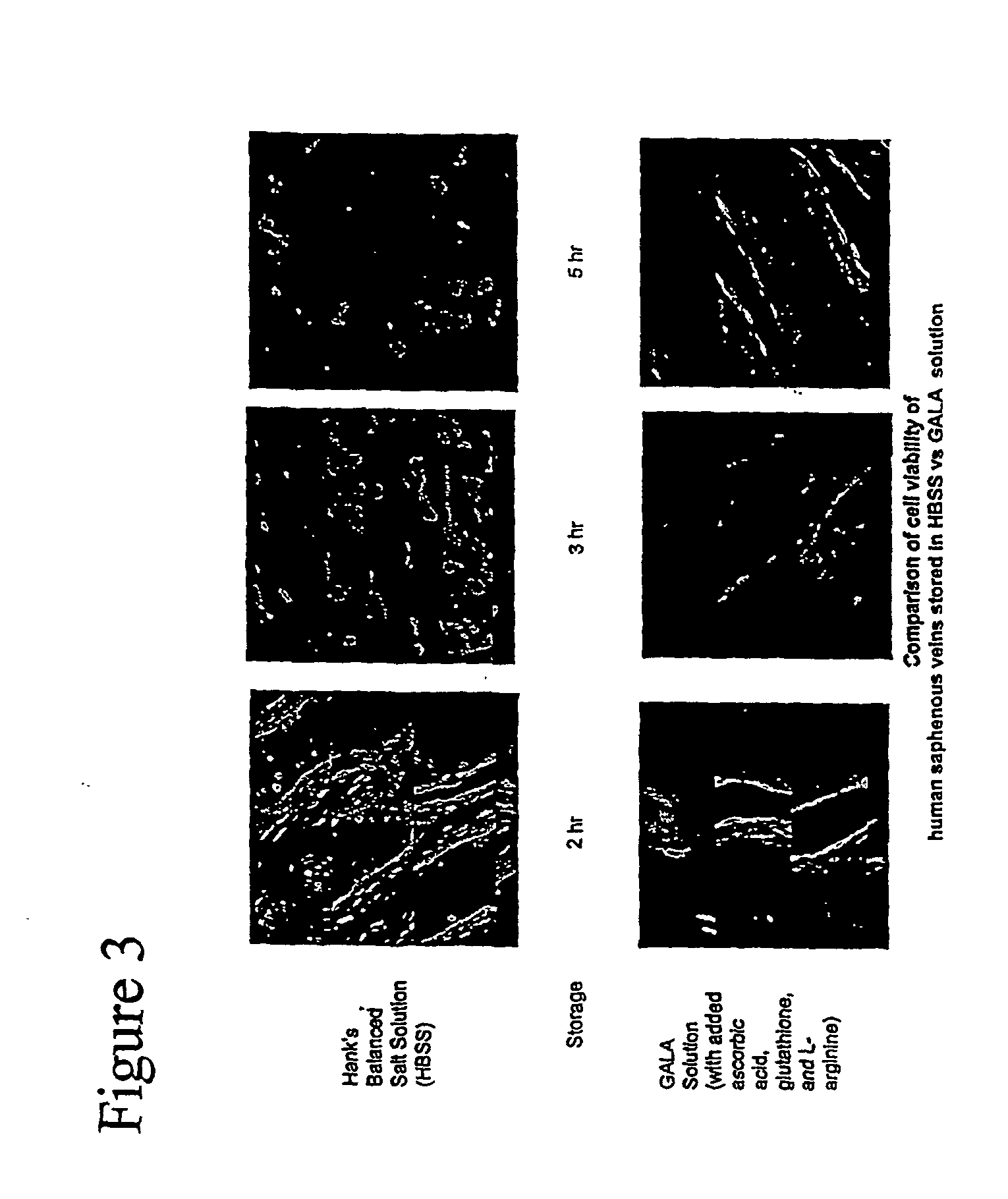 Composition and methods for tissue preservation