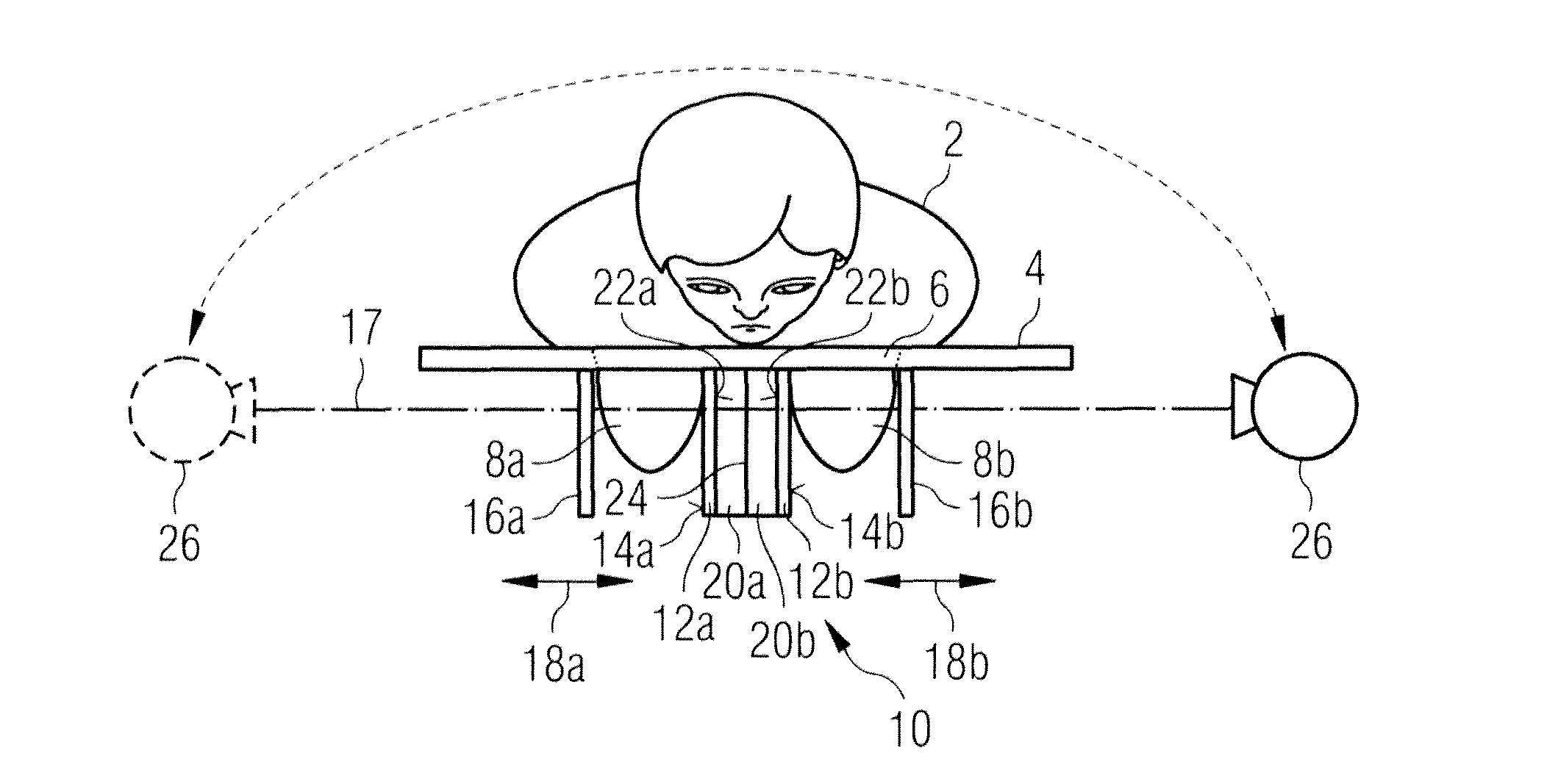 Mammography method and mammography apparatus