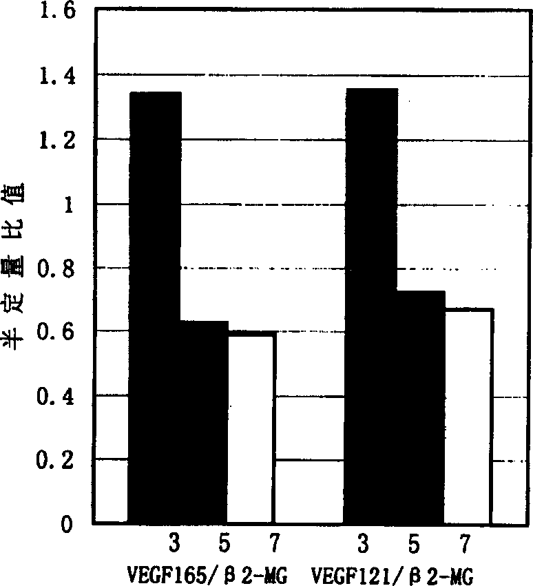 Antisense nucleic acid medicine composition with bcr3/abl2 and VEGF gene function inhibition and use thereof