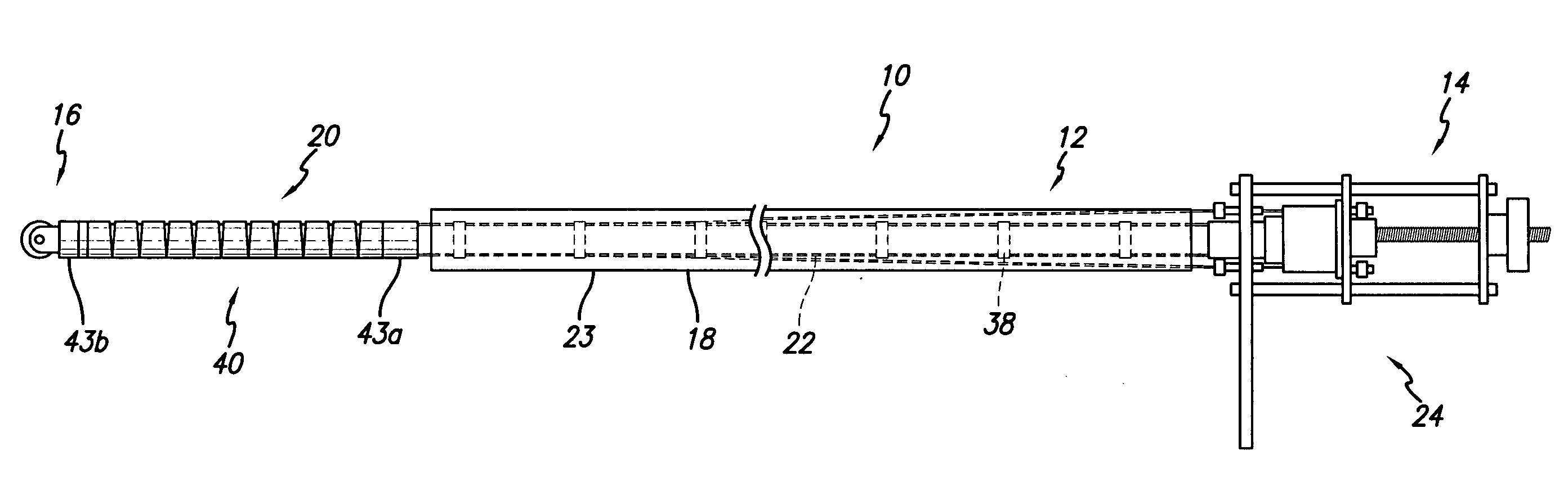 Remote tissue retraction device