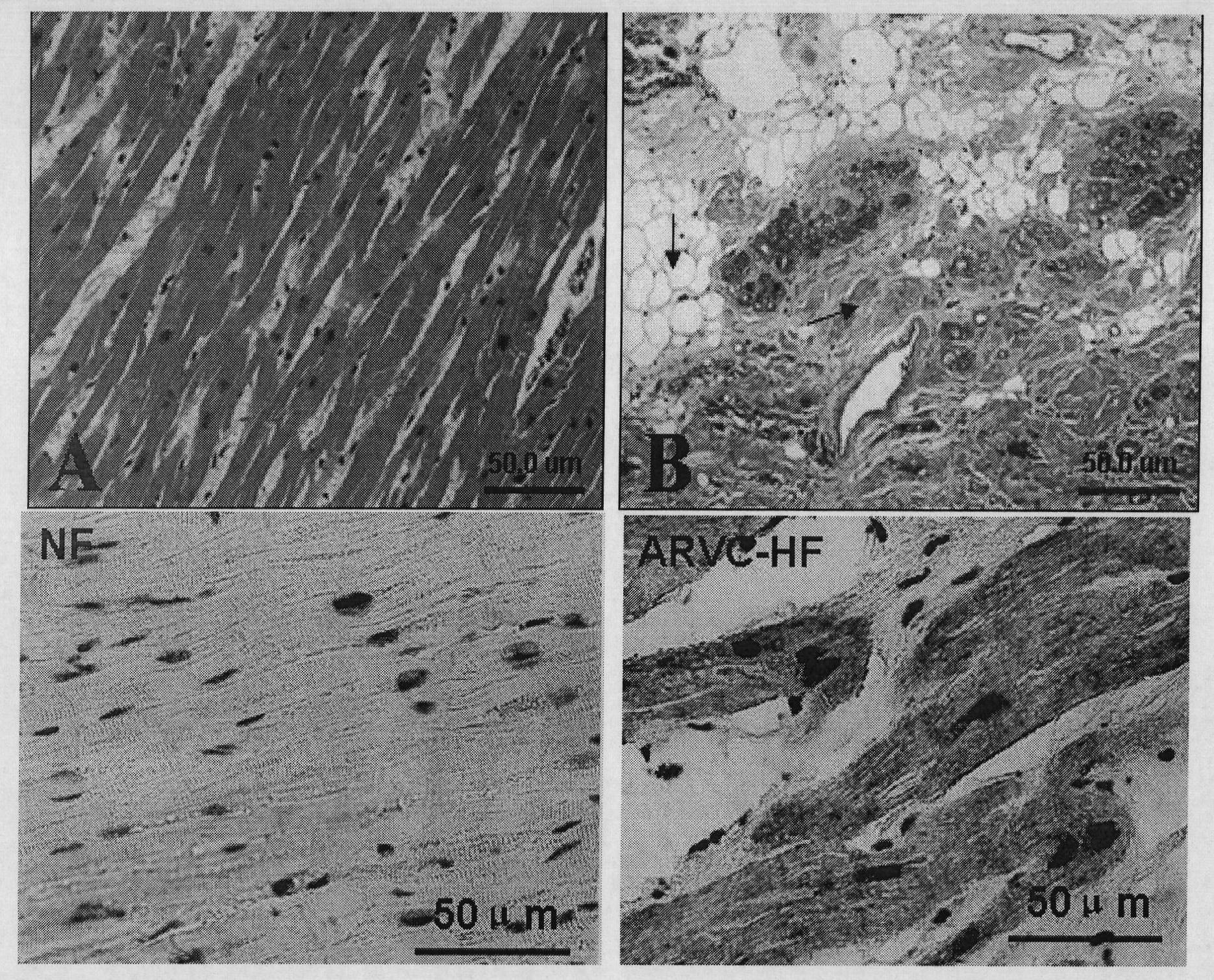 Application of dermatopontin in preparing kit for detecting cardiac failure and detection kit