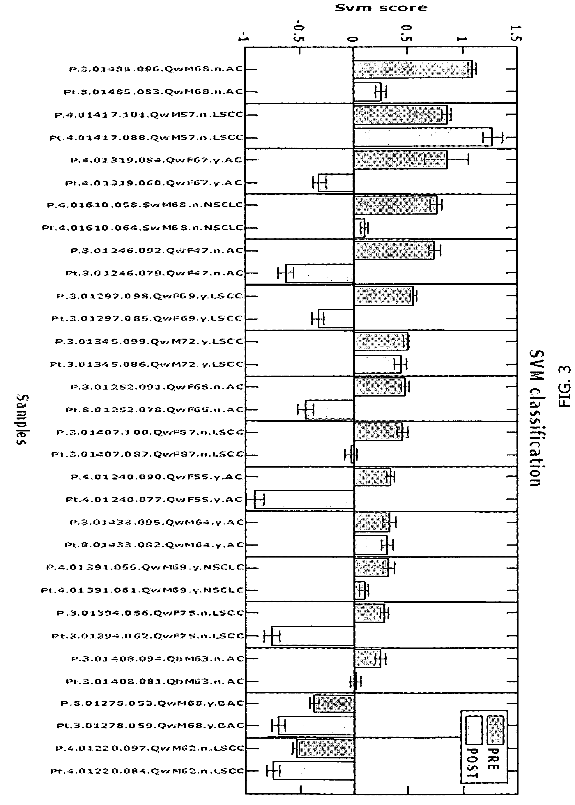 Method for diagnosing lung cancers using gene expression profiles in peripheral blood mononuclear cells