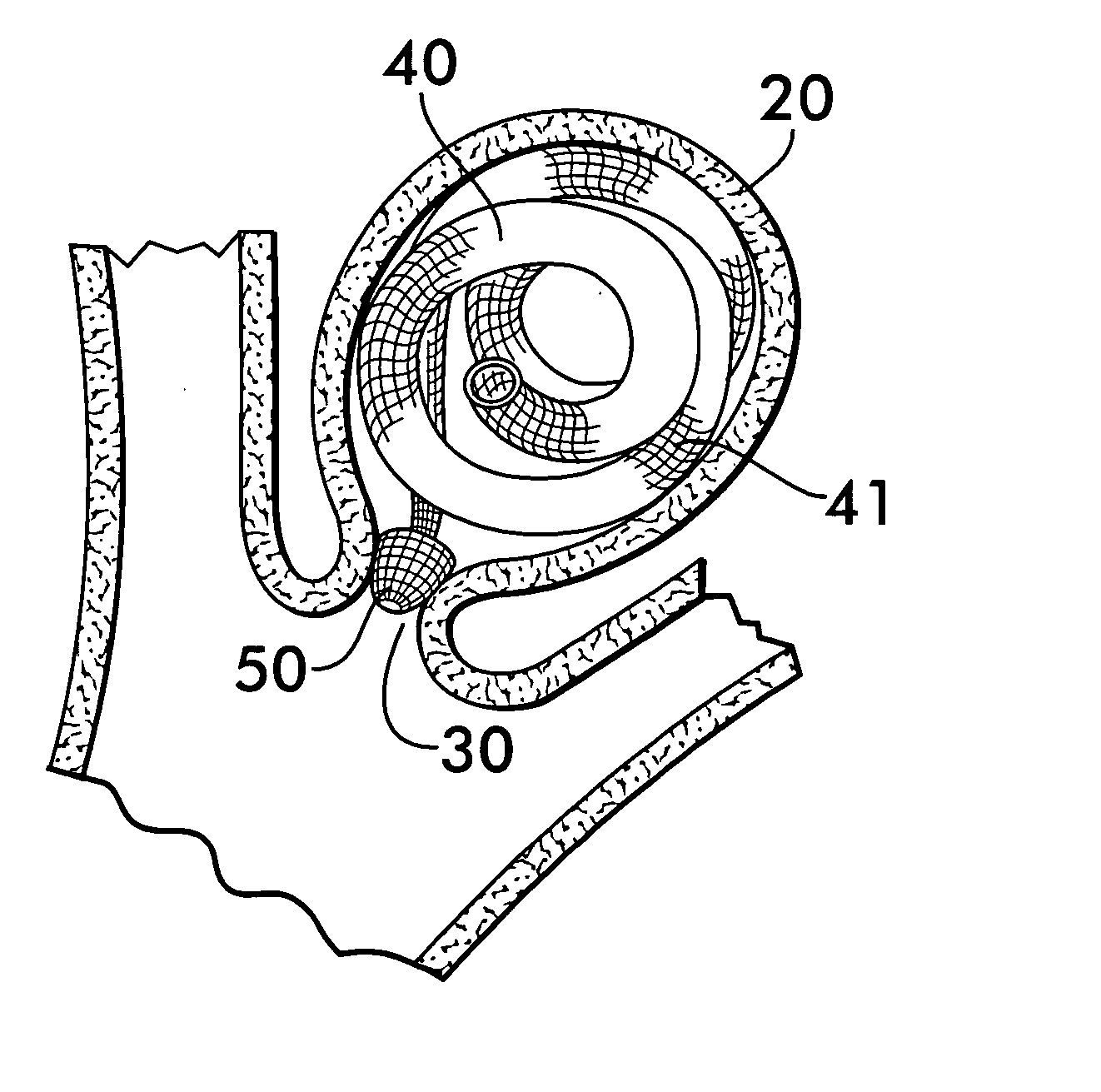 Three-dimensional coils for treatment of vascular aneurysms