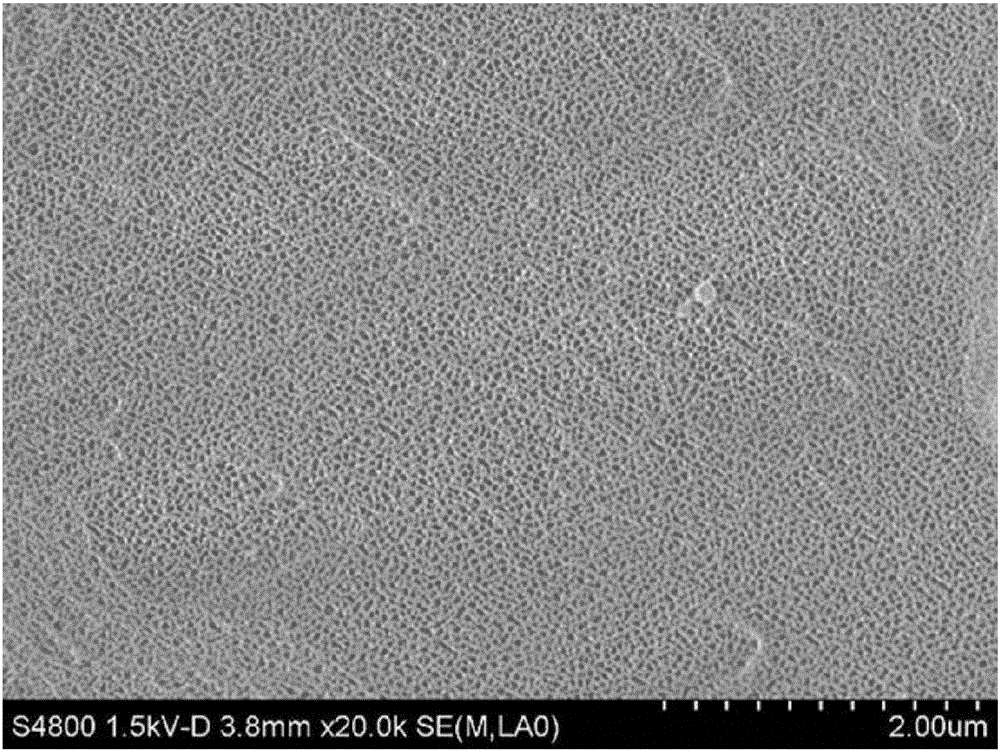 Treatment method for aluminum metal surface and aluminum metal shell