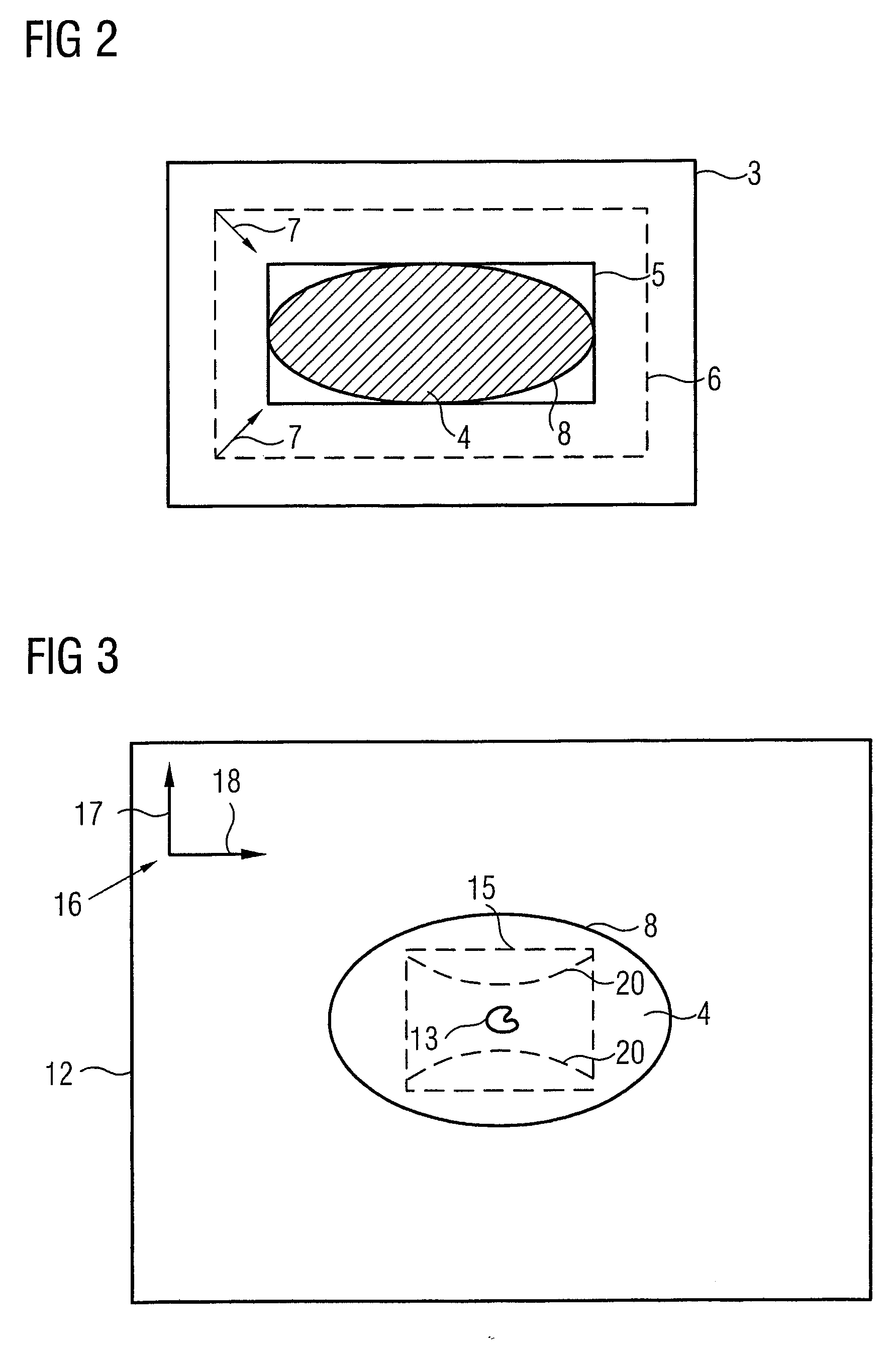 Method for image data acquisition with a magnetic resonance device